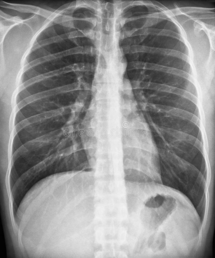 Raios-X Digital em Americana, SP - Clínica Rossetti